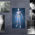 NL24 - artrosi e sua prevenzione - dove